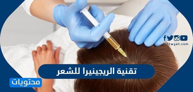 ما هي تقنية الريجينيرا للشعر وعدد الجلسات التي يحتاجها المريض