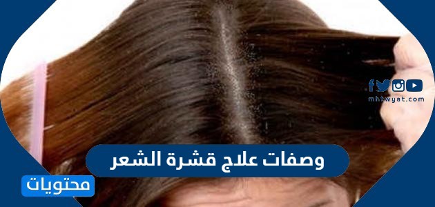 وصفات علاج قشرة الشعر بطرق طبيعية والاستغناء عن المواد الكيميائية
